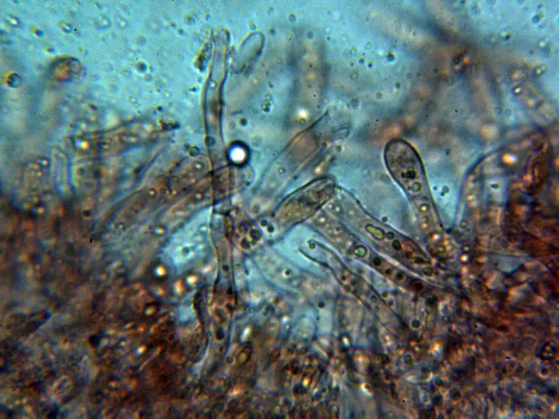 Cantharellus pallens 10 - Caulocistidios 2